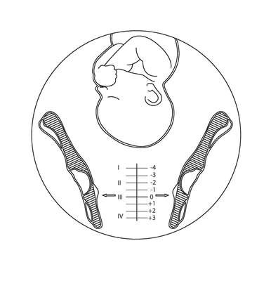 PADRÃO ORNAMENTAL APLICADO A/EM RÉGUA OBSTÉTRICA