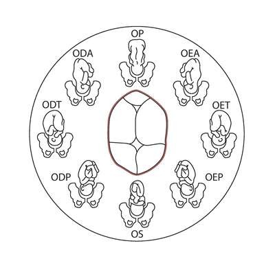 PADRÃO ORNAMENTAL APLICADO A/EM RÉGUA OBSTÉTRICA