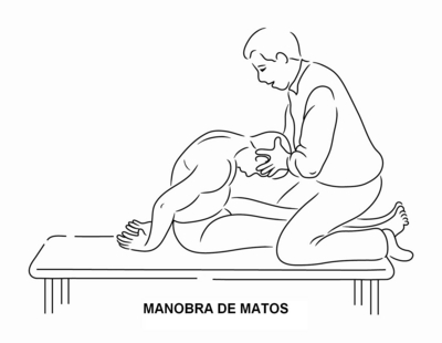 MANOBRA DE MATOS