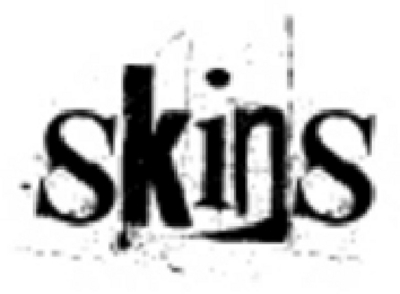 SKINS